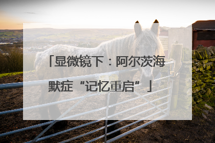 显微镜下：阿尔茨海默症“记忆重启”